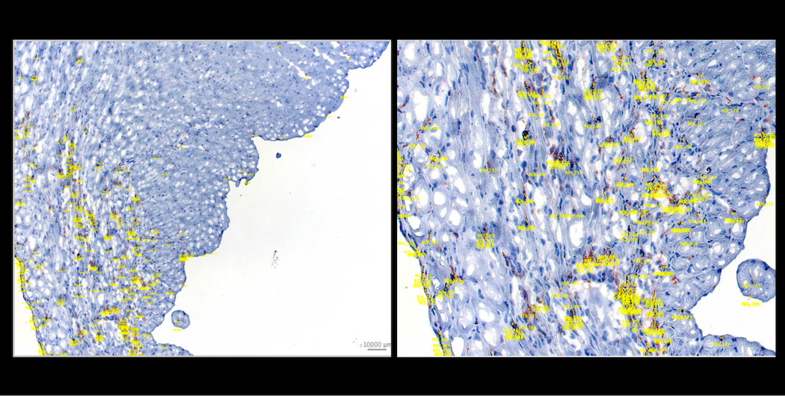 IHC image with detected ROI polygons overlaid in yellow in OMERO. Left: full image scale showing the overall distribution of CD11b-positive detections. Right: zoomed view showing individual ROIs corresponding to small DAB-positive cells scattered across the cardiac tissue.