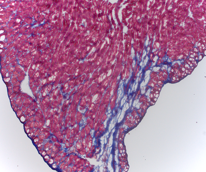 Example Masson's Trichrome image showing collagen in blue (aniline blue), muscle in red (Biebrich scarlet), and nuclei in dark purple. Blue area reflects fibrotic remodeling.