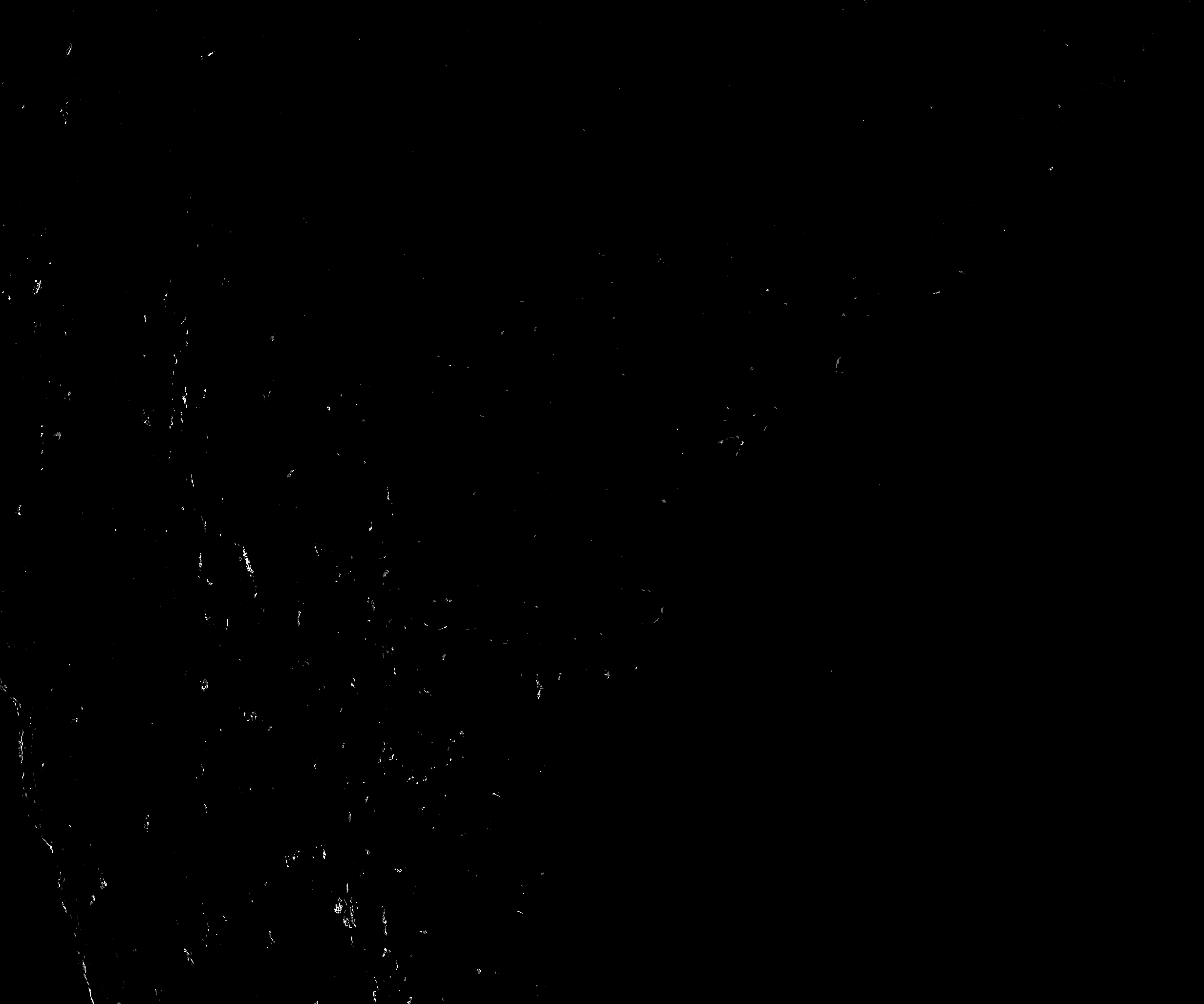 Isolated DAB channel after splitting the deconvolution output. The grayscale image shows the CD11b/DAB signal separated from the other stain components.