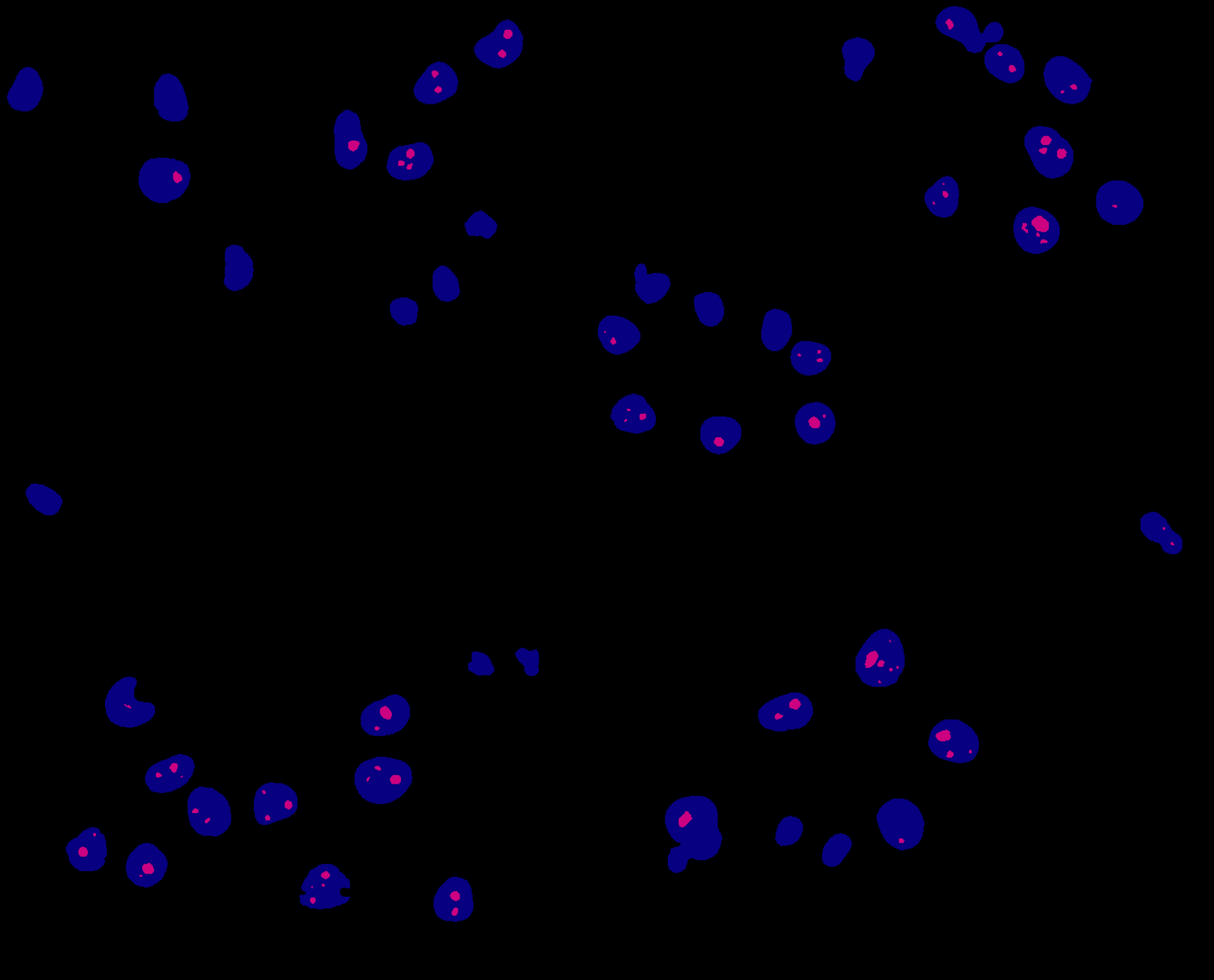 image of the cells again, but now cells are blue and nuclei/nucleoli are red.