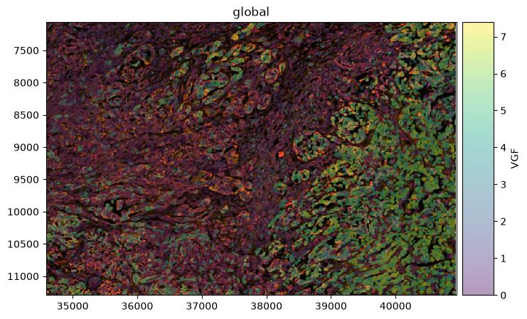 Spatial map of VGF expression, showing concentration in melanocytic groups 2 and 5.