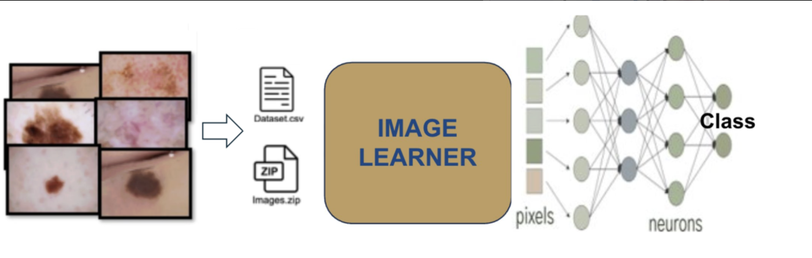 Workflow overview for HAM10000 classification in GLEAM Image Learner. 
